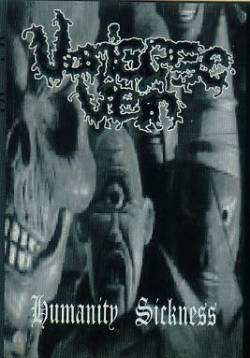 Varicose Vein : Humanity Sickness